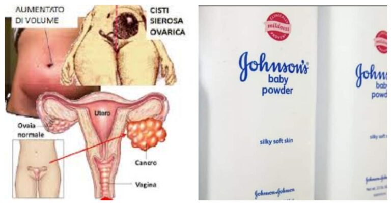 JOHNSON & JOHNSON PAGHERÀ 6,5 MILIARDI DI DOLLARI PER CHIUDERE LE CAUSE SUL CANCRO ALLE OVAIE PROVOCATO DAL TALCO